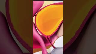 Urinary incontinence causes and symptoms 3danimation medicalanimation [upl. by Vharat707]