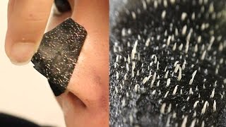 BEST WAY TO MAKE PORE STRIPS WORK BETTER NOT CLICKBAIT [upl. by Frohne]