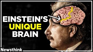 How Einstein’s Unique Brain Made Him Smarter [upl. by Anigroeg]