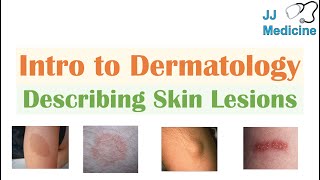 Introduction to Dermatology  The Basics  Describing Skin Lesions Primary amp Secondary Morphology [upl. by Nnyw]