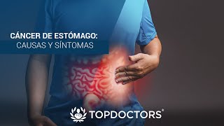 Cáncer de Estómago causas y síntomas [upl. by Radman751]