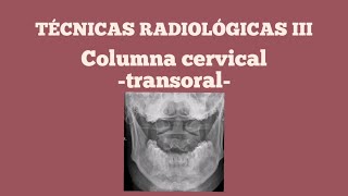 Proyección transoral de columna cervical [upl. by Dar497]