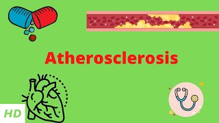 Atherosclerosis Causes Signs and Symptoms Diagnosis and Treatment [upl. by Yelnats]