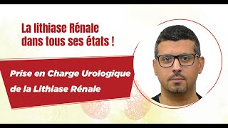 Prise en charge Urologique de la lithiase Rénale  Dr NGHERABI [upl. by Able]