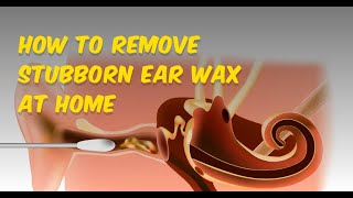 How to remove stubborn ear wax at home [upl. by Ardnek557]