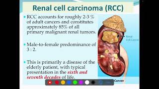 Renal cell carcinoma  RCC  Aetiology  Histopathology  spread [upl. by Naitirb894]