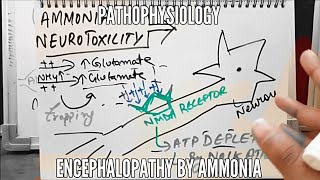 Ammonia Neurotoxicity  Encephalopathy  Pathophysiology [upl. by Livy847]