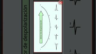 ECG 2  Vector de despolarización [upl. by Auop]