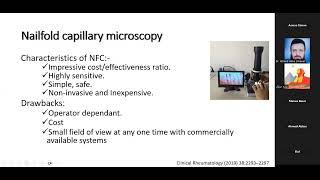 Nailfold capillaroscopy workshop day1 Dr Marwa Aboelmaaty Besar rheumatology amp immunology Mansoura [upl. by Sarene277]