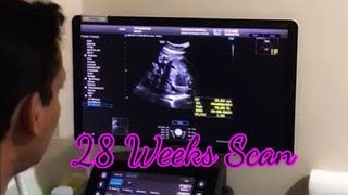 28 weeks pregnant ultrasound  DrProbhodana Ranaweera  Ninwells Hospital  28 weeks [upl. by Omidyar]