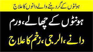 Mouth Blisters Causes and Treatment In Urdu  Honton Ke Chalo Ka ilaj  Honton ke dena ka ilaj [upl. by Goff]