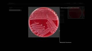 Lipohylic Test  Microbiology [upl. by Elgar885]