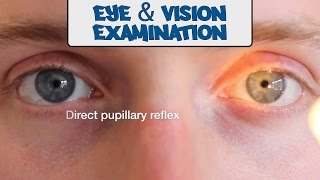 Examination of the Eyes and Vision  OSCE Guide old version  UKMLA  CPSA [upl. by Deuno]