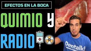 Así afecta a la BOCA la QUIMIOTERAPIA y RADIOTERAPIA ☢️ Efectos secundarios [upl. by Rialc946]