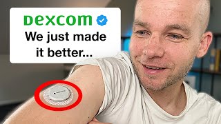 Dexcom G7 Major Upgrades Revealed – Don’t Miss Out [upl. by Adnerb]