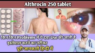 Althrocin 250 mg tablet use dose benefits and Side effects full review in hindi [upl. by Cinomod]