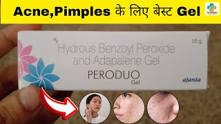 Peroduo Gel Use in Hindi  Benzoyl peroxide amp Adapalene Gel Use  Acne  pimples  SK MEDICINE [upl. by Einnus]