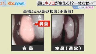 鼻トラブル患者が増加？その原因は… [upl. by Lekym607]