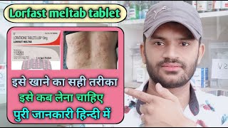 Lorfast meltab tablet use dose benefits and side effects full review in hindi loratadine [upl. by Blynn]