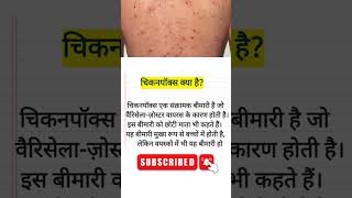 What is chickenpox caused by Chickenpox kya hota haiचिकनपॉक्सvaricella [upl. by Ztnaj725]