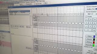 Charting Probing in a Returning Patient in Open Dental [upl. by Tema]