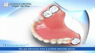 ¿Qué es una prótesis dental removible por Clínica Dental Virgen del Pilar [upl. by Bonacci88]