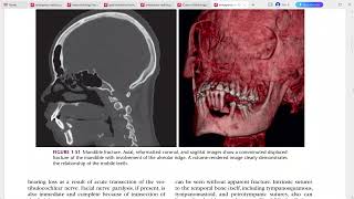 EMERGENCY RADIOLOGY REQUISITES [upl. by Elockin]