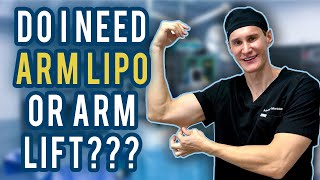 Do I Need Arm Lipo or Arm Lift [upl. by Monarski]