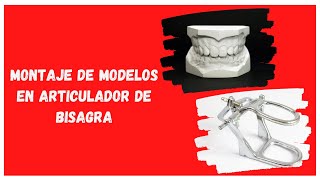 🦷Montaje de Modelos en Articulador de Bisagra🦷 [upl. by Analah]