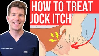 Doctor explains how to RECOGNISE AND TREAT JOCK ITCH aka Tinea Cruris or Ringworm of the groin [upl. by Cralg]