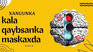 Dawada Xanuunka Schizophrenia [upl. by Arrehs]