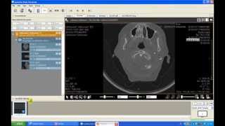 From dicom to jpg with Synedra [upl. by Deborah]