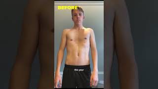 How Isaac improved his Severe case of Pectus Excavatum [upl. by Yatnoj]