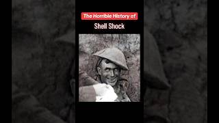 The Shocking History of “Shell Shock” [upl. by Golda]