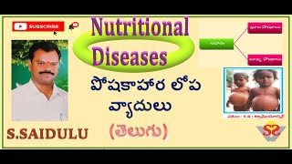 Nutritional deficiency diseases  Marasmus and Kwashiorkor  Types of nutrients  Macro nutrients [upl. by Deva]