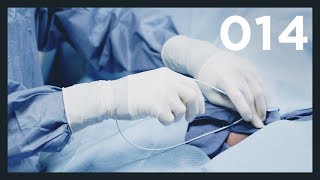 Interventional Radiology Fellowship  What To Expect  Vlog 014 [upl. by Yran]