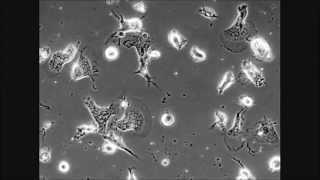 LRRK2 G2019S mutation attenuates microglial motility by inhibiting focal adhesion kinase [upl. by Dan]