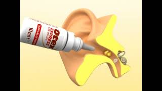 Ear Wax Removal Drops for Excessive Otex Express Clinically Proven buynow viral shorts eardrops [upl. by Kele524]