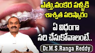 ఎత్తువంకర పళ్ళకి పరిష్కారం Teeth Straightening In Telugu DrMSRanga Reddy iDream Telugu Health [upl. by Inatirb]