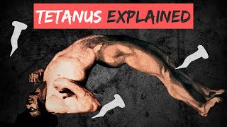 TETANUS explained in 10 Minutes [upl. by Ahsram]