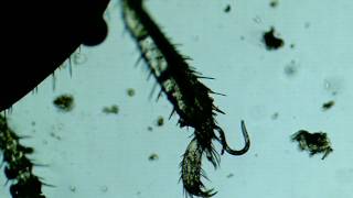 A Termite and its Pests Mites and Nematodes [upl. by Nehtanhoj]