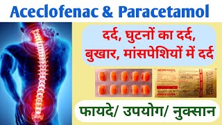 Aceclofenac amp Paracetamol Tablet Movidol Tablet  Acecross  P Tablet [upl. by Yrrum]