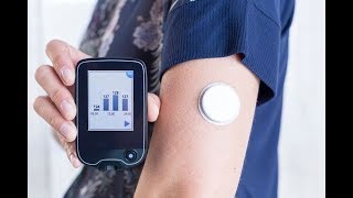 Episode 323  CGMS  Continuous Glucose Monitoring [upl. by Ilojne]