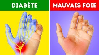 12 Problèmes de Santé Que Tes Mains T’indiquent [upl. by Maryn]