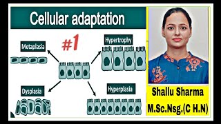 Cellular Adaptation TypesAtrophy HypertrophyPhysiological and pathological Atrophy [upl. by Brody]