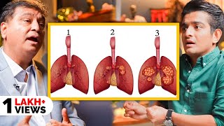 Cancer Stage 1 To Stage 4  Easy Hindi Explanation By Doctor [upl. by Ylekalb246]