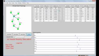 VHM Virtual heart model AVNRT simulation [upl. by Caril]