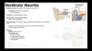 👂 Vestibular Neuritis  Presentation Pathophysiology Diagnosis amp Treatment [upl. by Garling401]