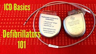 Defibrillators 101  The Basics Of An Implantable Cardioverter Defibrillator ICD [upl. by Lynda]