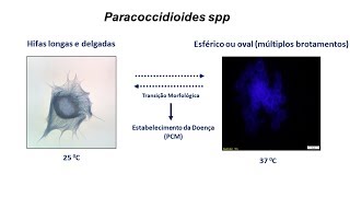 Superexpressão da paracoccina fenótipo e virulência de linhagens de Paracoccidioides brasiliensis [upl. by Iuqcaj806]